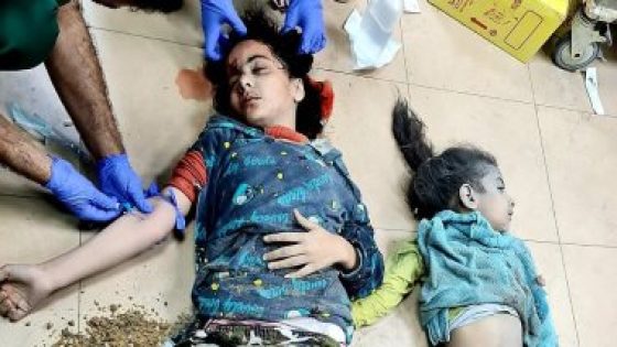 طبيب فرنسى عائد من غزة: القناصة الإسرائيليون يستهدفون رؤوس البالغين والأطفال